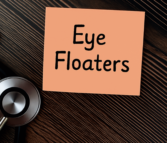 Eye floaters